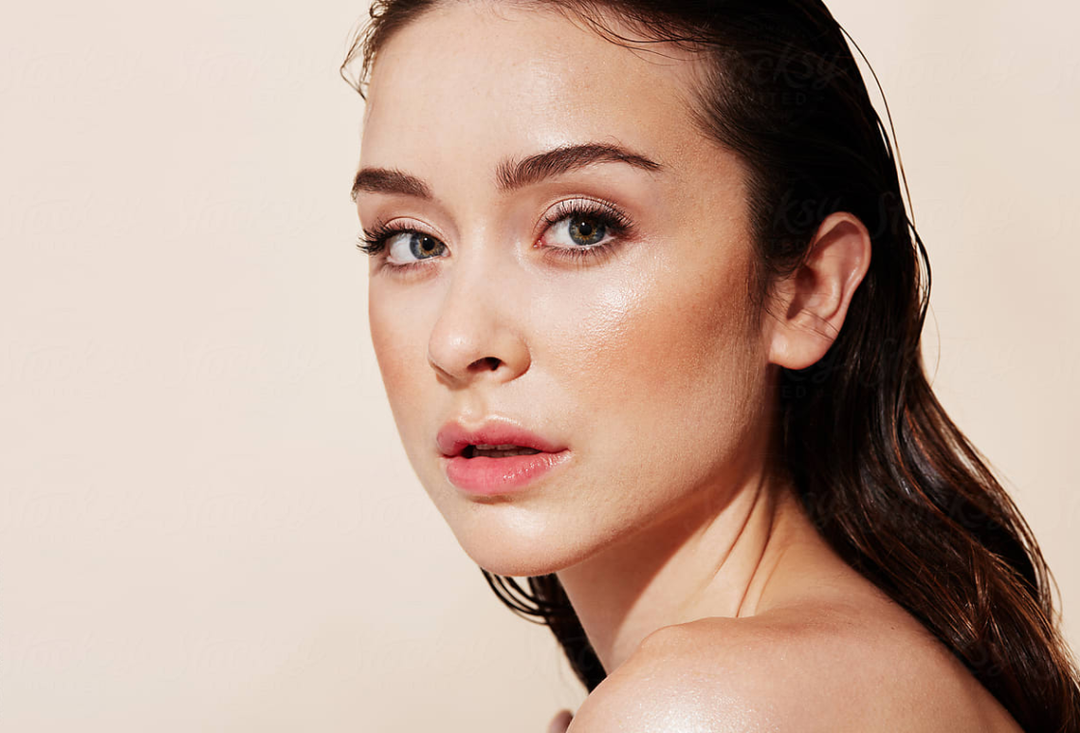 Woman in her late 20s with clean fresh skin and no makeup after microneedling treatment